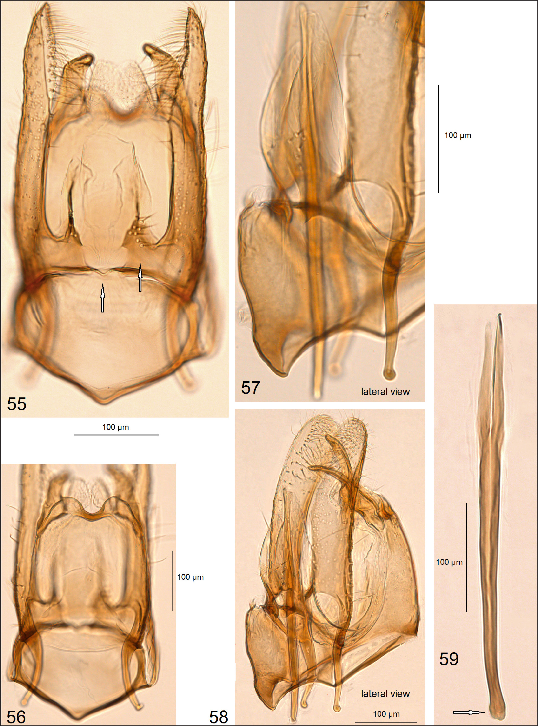 Aedeagus lateral view: 90, 92, 94, 96, 98, 100; parameres dorsal view